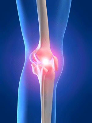 osteo and rheumatoid arthritis ayurvedic treatment